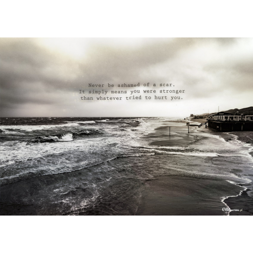 #167_p Never be ashamed of a scar. It simply means you were stronger